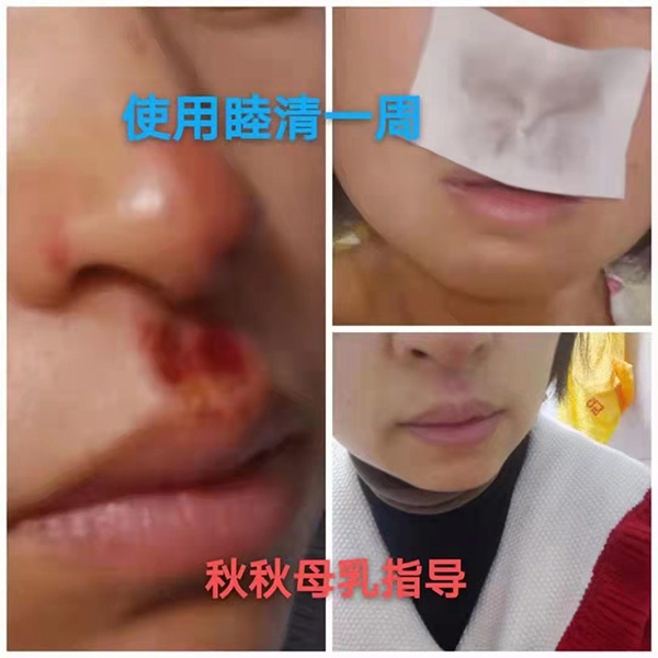 �����澏���N���Æ������M�߿ڱ������������a(ch��n)ƷȦ�۟o��(sh��)